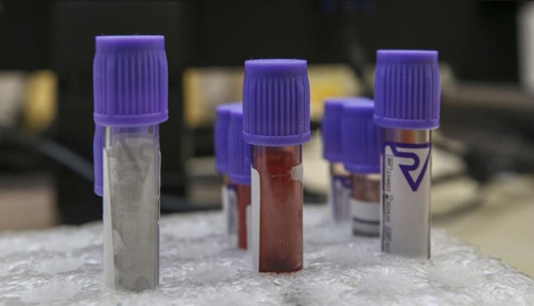 İngiltere’de denenen kan testiyle her üç kanserden ikisi tespit edildi