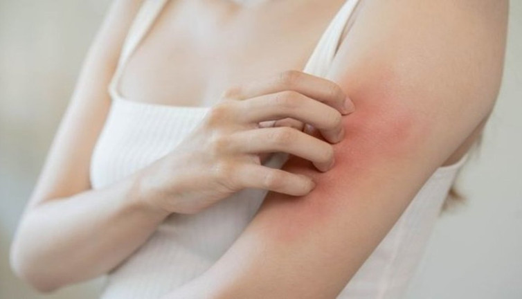 Yaz gelmeden mutlaka önleminizi alın. Bu gıdaları tüketenlere sivrisinekler yaklaşmıyor