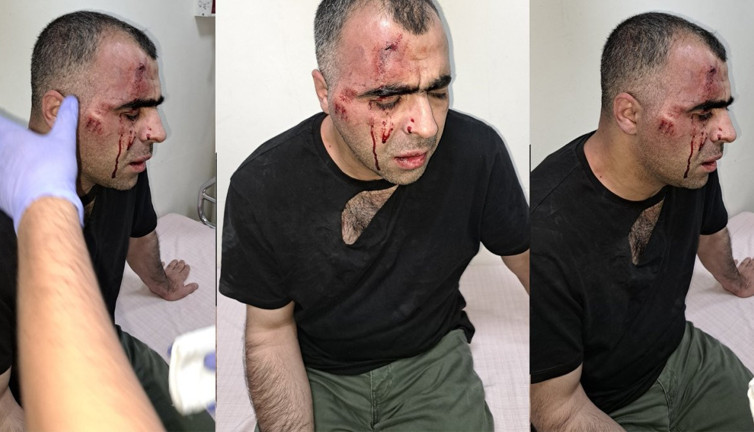 AKP’li belediyedeki usulsüzlük iddialarını gündeme getirdiği için silahlı saldırıya uğramıştı. Gazeteci Sinan Aygül'ü darp eden korumalar açığa alındı