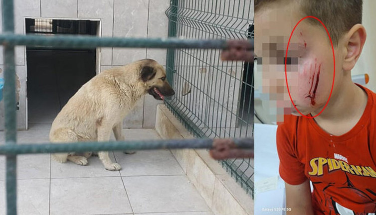Sokak köpeği 7 yaşındaki Umut’un yüzünü parçaladı