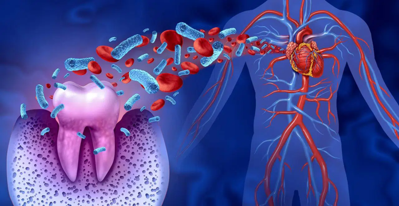 Ağızda başlayan tehlike: Diş çürüğü sandığınız şey sadece diş çürüğü olmayabilir - Resim: 4