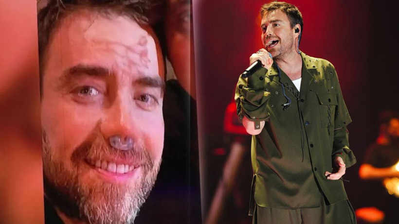 Ünlü şarkıcı Murat Dalkılıç'ın son hali hayranlarını endişelendirdi! 12. kez bıçak altına mı yattı? - Resim: 1