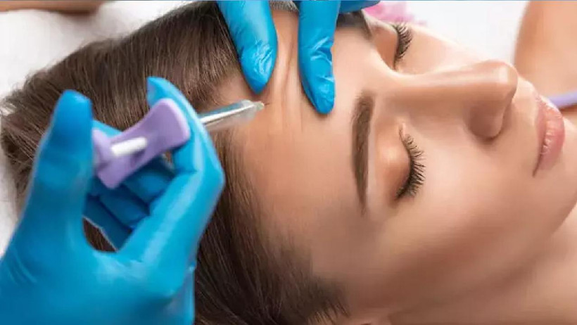 'Botoks yaptıranın beyni çalışmaz' iddiası gerçek mi şehir efsanesi mi: Dermatologlardan net yanıt - Resim : 2