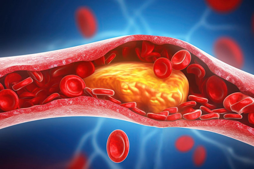 Uzmanından kalp sağlığı için 5 kritik uyarı: Kalp krizlerinin %90’ı önlenebilir - Resim: 9