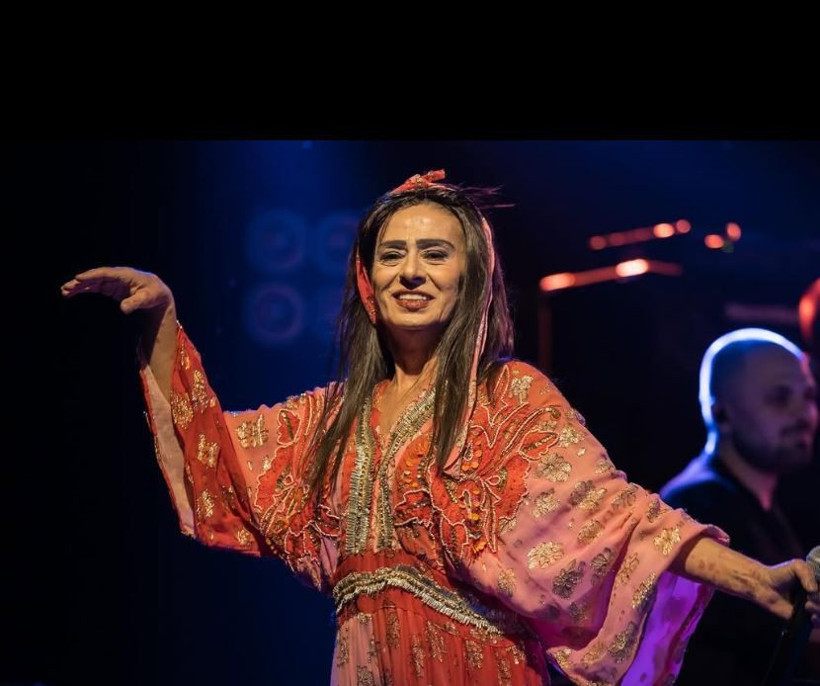 Yıldız Tilbe'yi örümcek ısırdı! Aksilikler kraliçesi... Yüzü korkuttu - Resim: 8