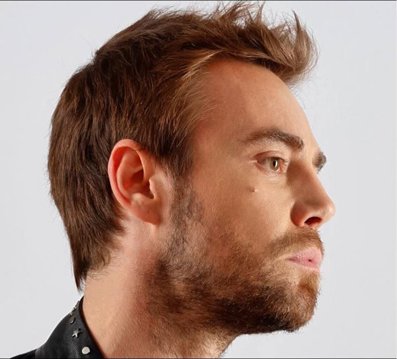 Ünlü şarkıcı Murat Dalkılıç'ın son hali hayranlarını endişelendirdi! 12. kez bıçak altına mı yattı? - Resim: 49