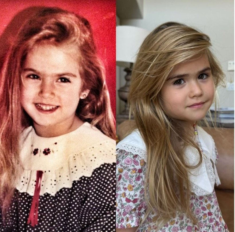 Ünlü oyuncu Ceyda Ateş sağlık sorunuyla korkuttu! Ağrısı çekilmez hal aldı - Resim : 3