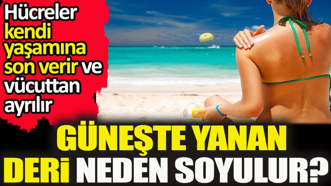 Güneşte yanan deri neden soyulur? Hücreler kendi yaşamına son verir ve vücuttan ayrılır - Resim: 1