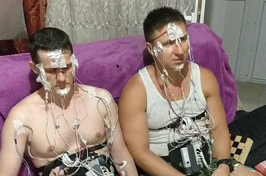 Nalburdan aldığı matkapla kafatasını deldi ölümden döndü. Operasyonun arkasındaki sebep duyanları şok etti - Resim: 4