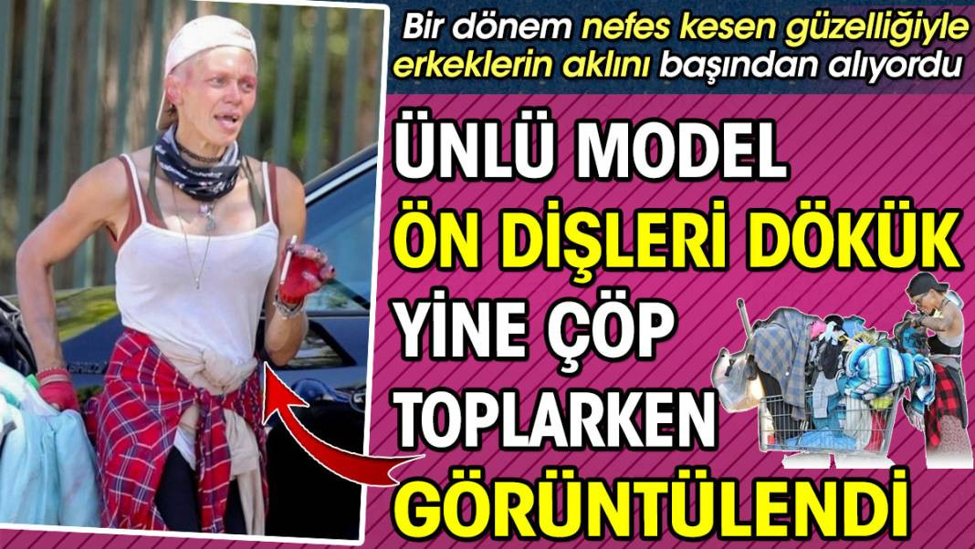 Ünlü model Loni Willison ön dişleri dökük yine çöp toplarken görüntülendi - Resim: 1