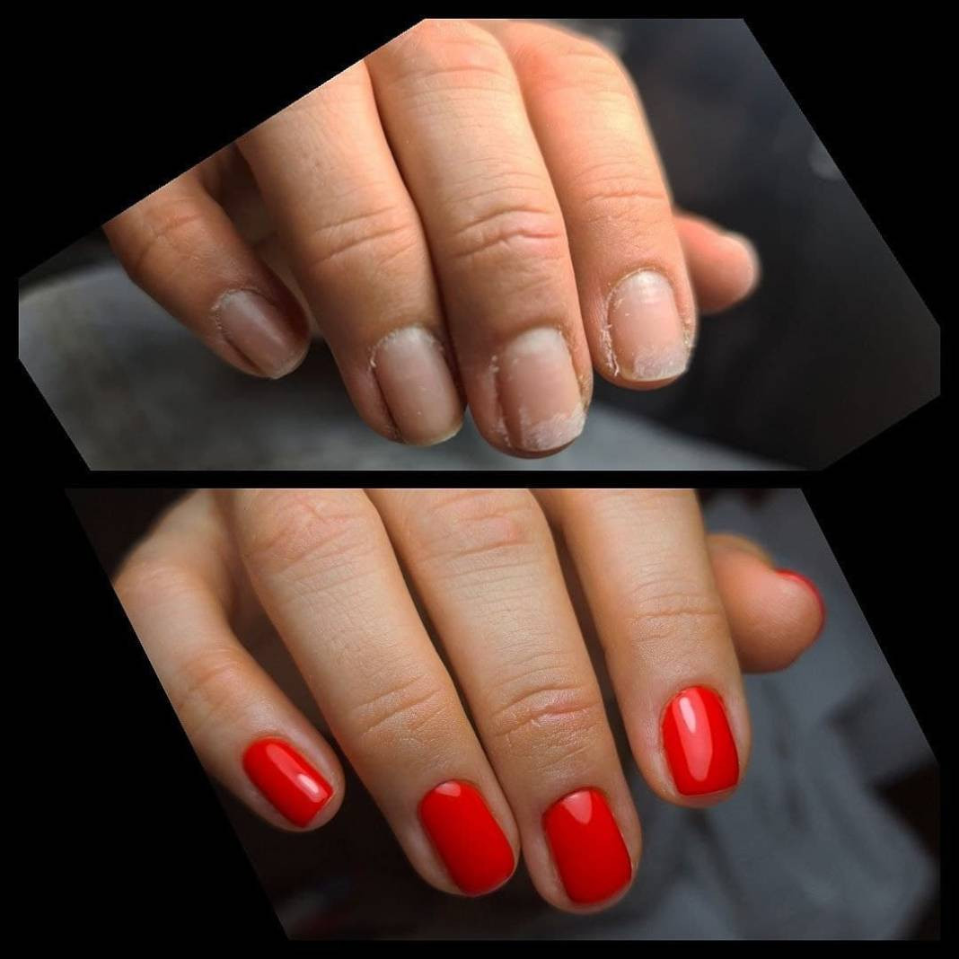 Kalıcı ojedeki gizli tehlike. Tırnaklarınız güzel görünsün diye bu riske girmeyin - Resim: 2