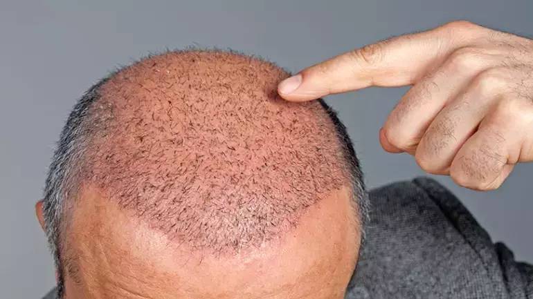 Türklerin bilmesi gereken 14 ilginç bilgi - Resim: 10