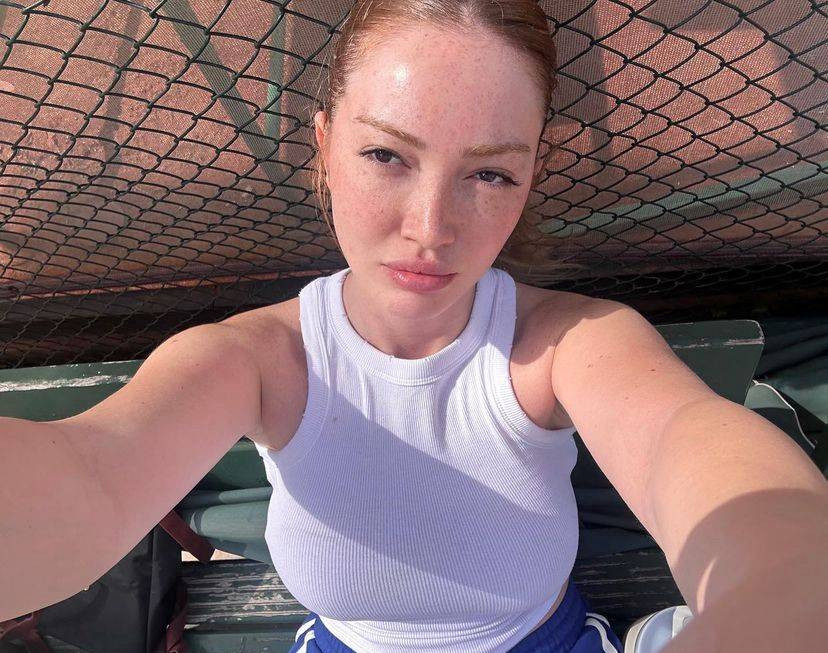 Danla Bilic yaptırdığı estetik operasyonları açıkladı - Resim: 9