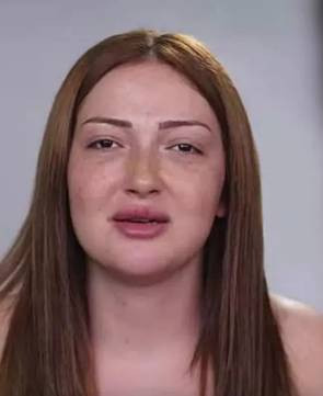 Danla Bilic yaptırdığı estetik operasyonları açıkladı - Resim: 14