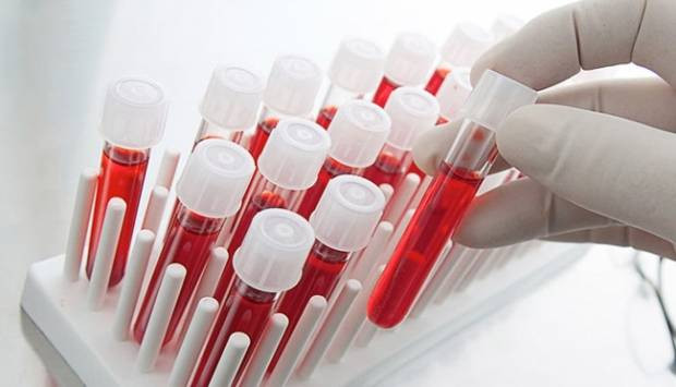 Kan grubunu bilen herkesi ilgilendiriyor - Resim: 6