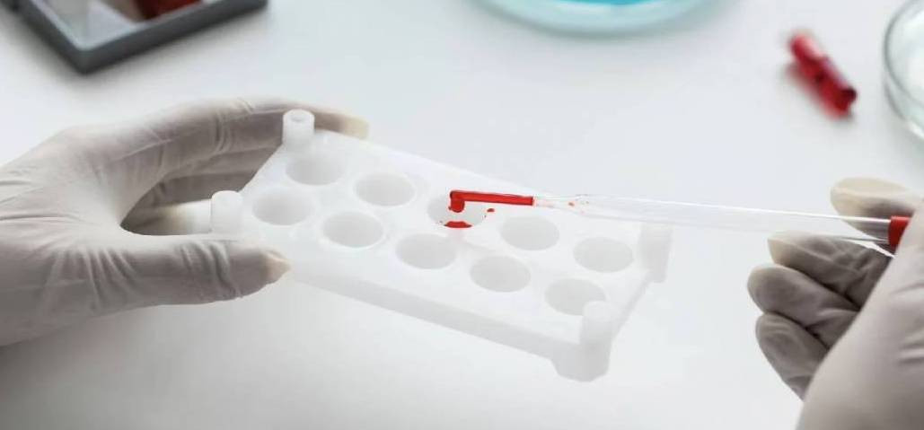 Kan grubunu bilen herkesi ilgilendiriyor - Resim: 9