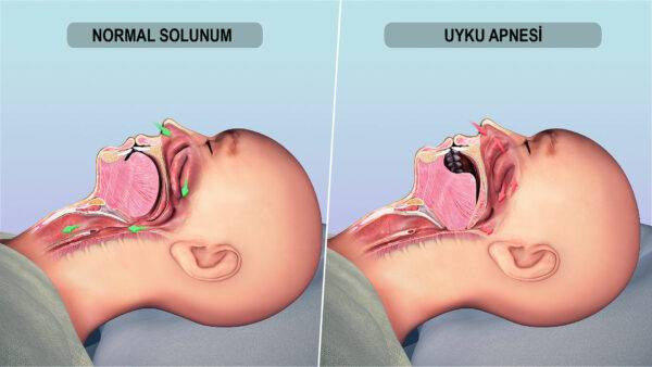 Bu kişiler artık ehliyet alamayacak. Yasal zorunluluk geliyor - Resim: 10