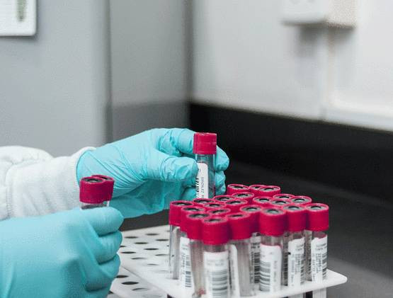 Kan grubunu bilen herkesi ilgilendiriyor - Resim: 5