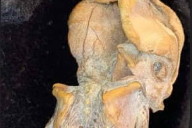 Bilim insanları çekik gözleri uzun kafası bulunan fetüsün sırrına ulaştı. Dünyayı korkutan görüntüler - Resim: 4