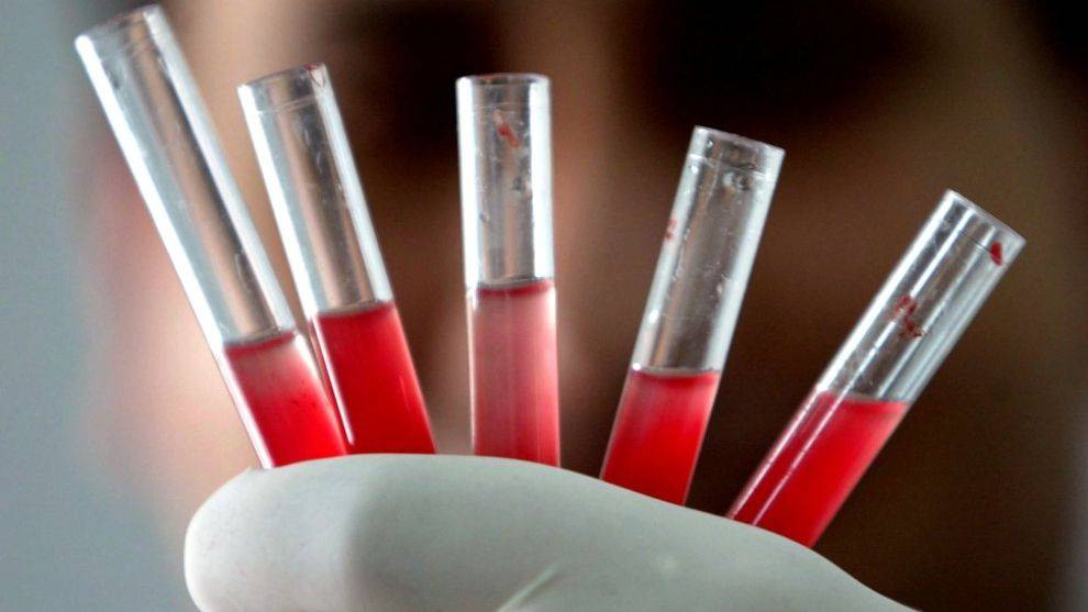 Kan grubunu bilen herkesi ilgilendiriyor - Resim: 1