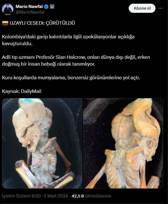 Bilim insanları çekik gözleri uzun kafası bulunan fetüsün sırrına ulaştı. Dünyayı korkutan görüntüler - Resim: 6