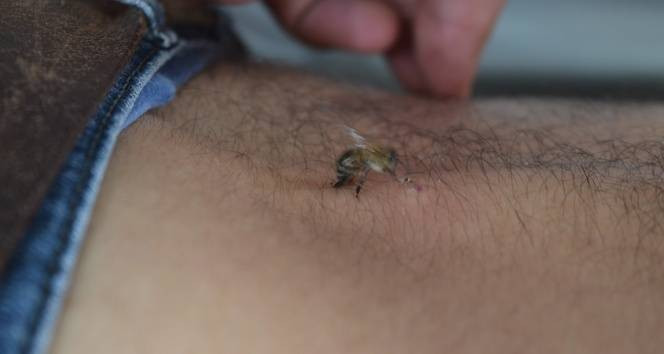 5 bin yıllık ilaçsız tedavi şifa dağıtıyor! Hastaneye iki büklüm giren dimdik çıkıyor - Resim: 3