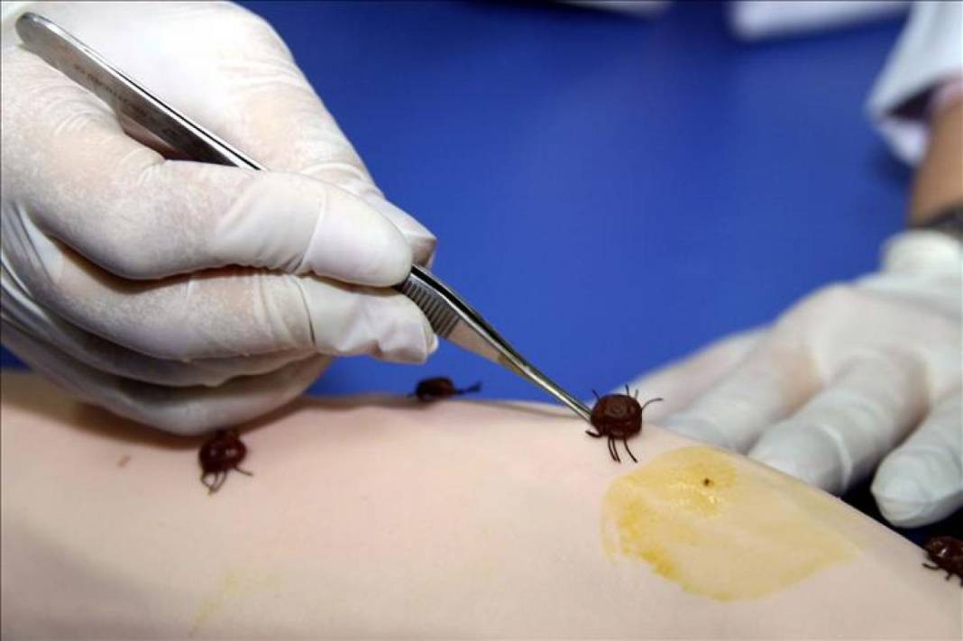 İnsandan insana kan ve vücut sıvılarıyla bulaşıyor. Uzmanlardan o şehirlerde yaşayanlara kritik uyarı - Resim: 4