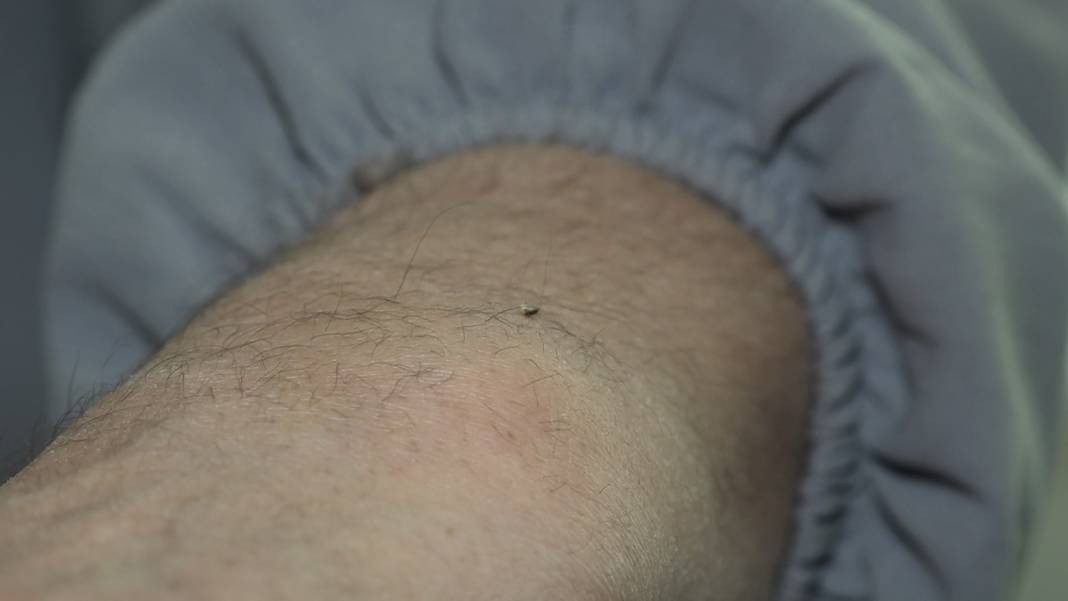 5 bin yıllık ilaçsız tedavi şifa dağıtıyor! Hastaneye iki büklüm giren dimdik çıkıyor - Resim: 7