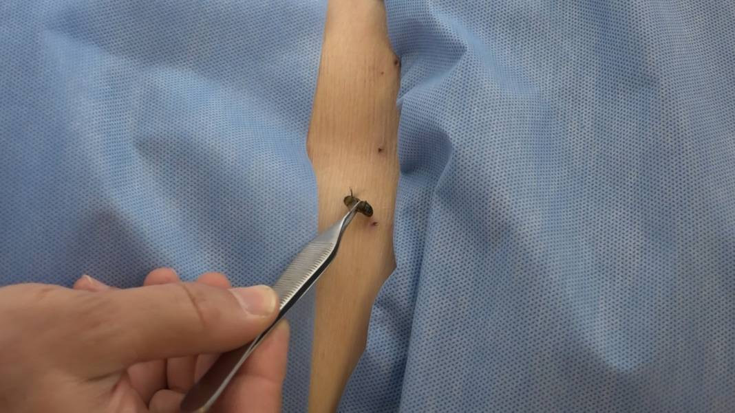 5 bin yıllık ilaçsız tedavi şifa dağıtıyor! Hastaneye iki büklüm giren dimdik çıkıyor - Resim: 5