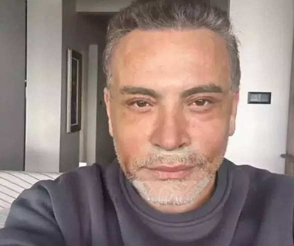 Türkiye'nin George Clooney'si Cenk Eren yüz gerdirme ameliyatı sonrası yeni halini paylaştı. Takipçileri 'Bu kim' diye sordu - Resim: 4
