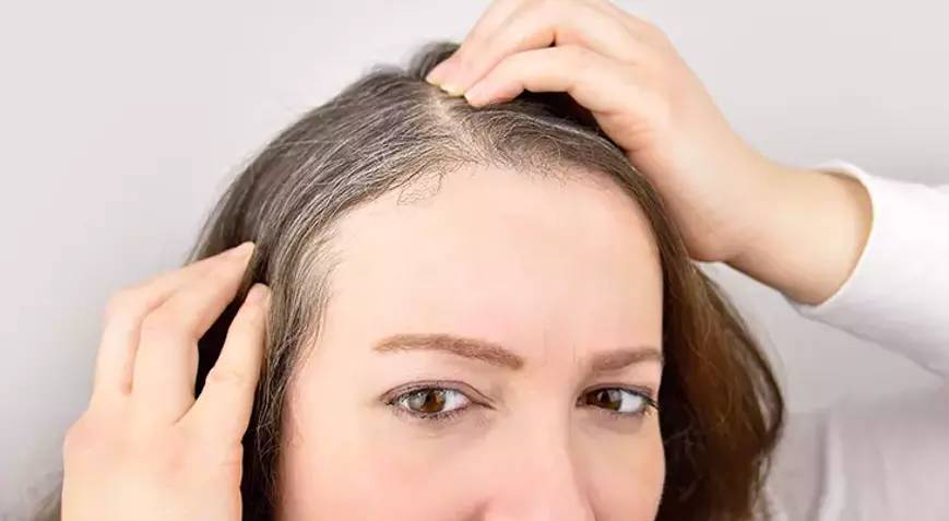 Saç beyazlamasını tersine çeviriyor. Çöpe attığınız her gün için pişman olacaksınız - Resim: 9