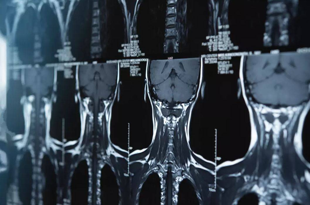 Sigara umulmadık yerinde saç çıkarttı! Doktorların nutku tutuldu - Resim: 5