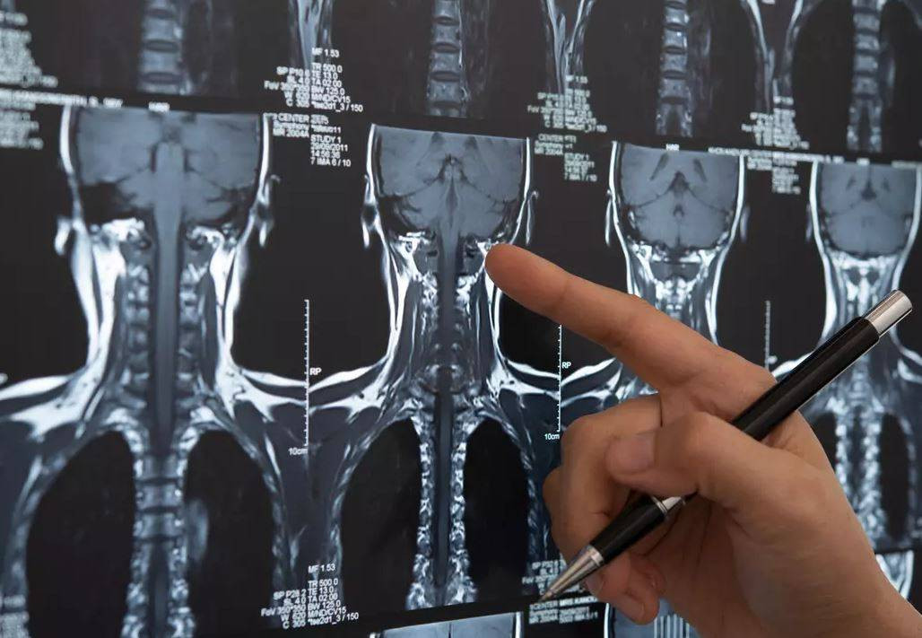 Sigara umulmadık yerinde saç çıkarttı! Doktorların nutku tutuldu - Resim: 6