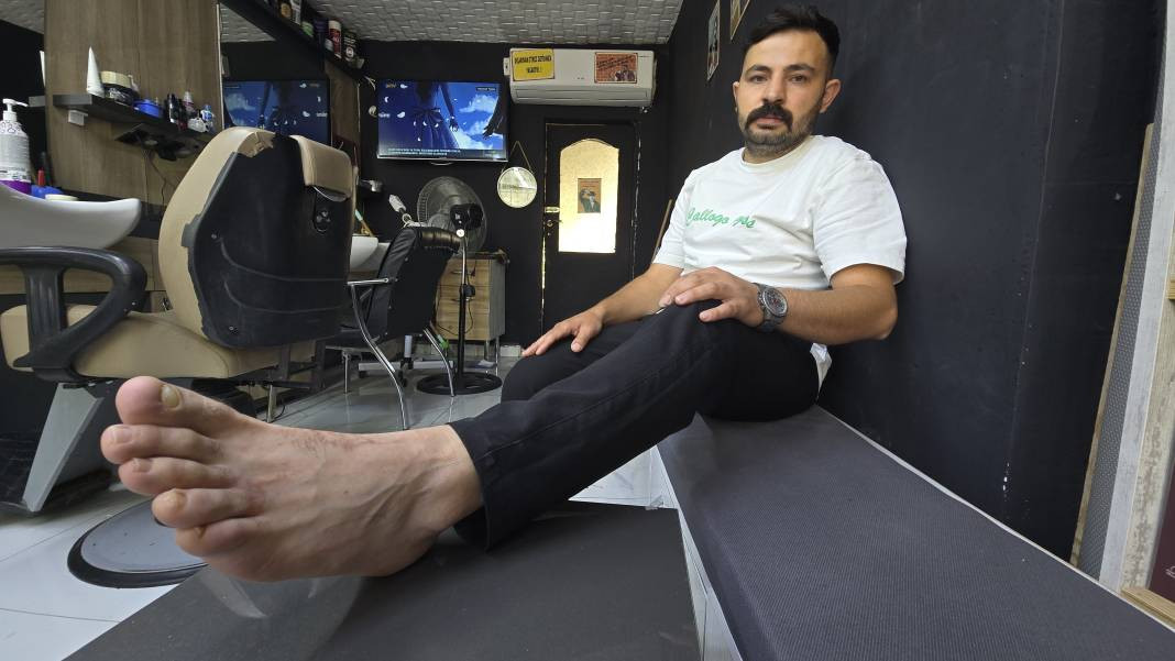 Yüzme havuzunda felaket! Dokundukları gibi yanmaya başladılar - Resim: 2