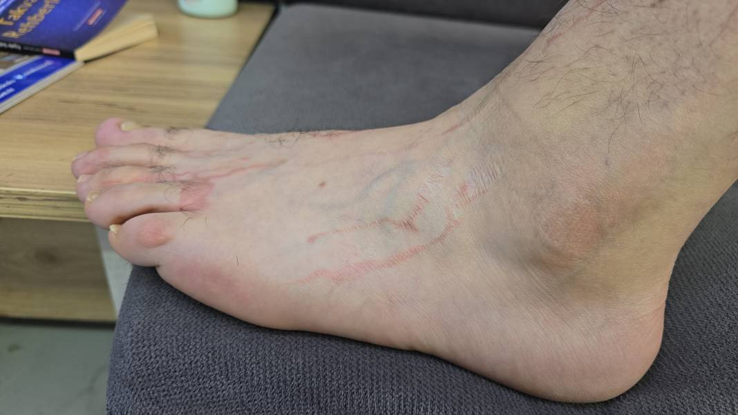 Yüzme havuzunda felaket! Dokundukları gibi yanmaya başladılar - Resim: 4