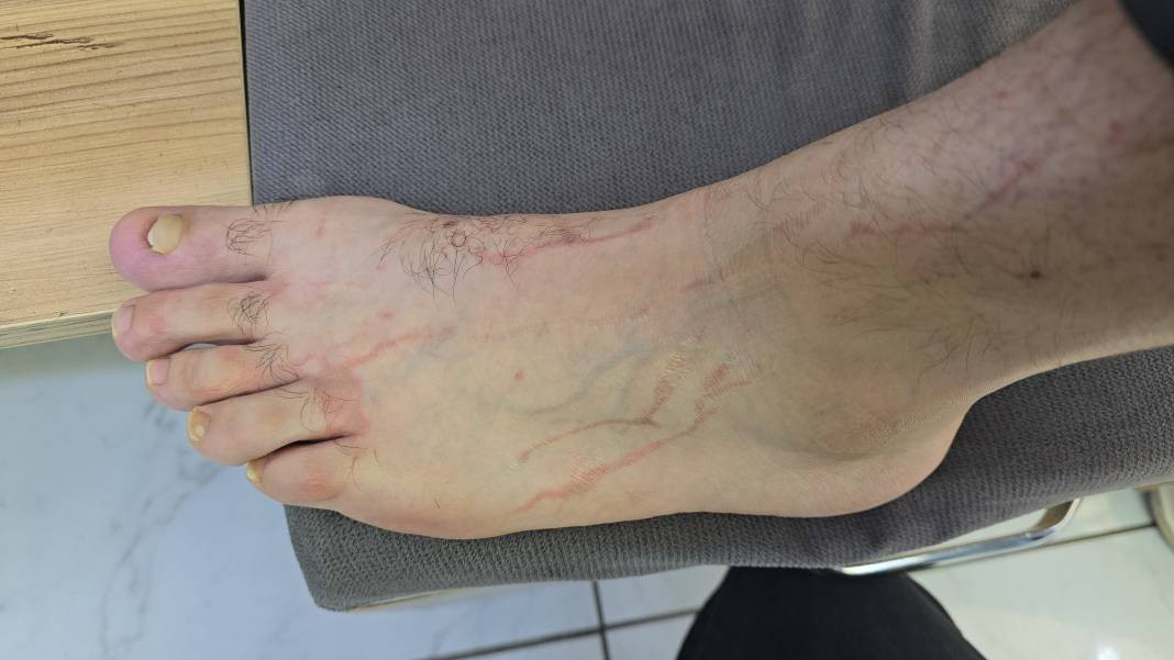 Yüzme havuzunda felaket! Dokundukları gibi yanmaya başladılar - Resim: 5