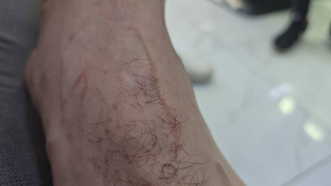 Yüzme havuzunda felaket! Dokundukları gibi yanmaya başladılar - Resim: 7