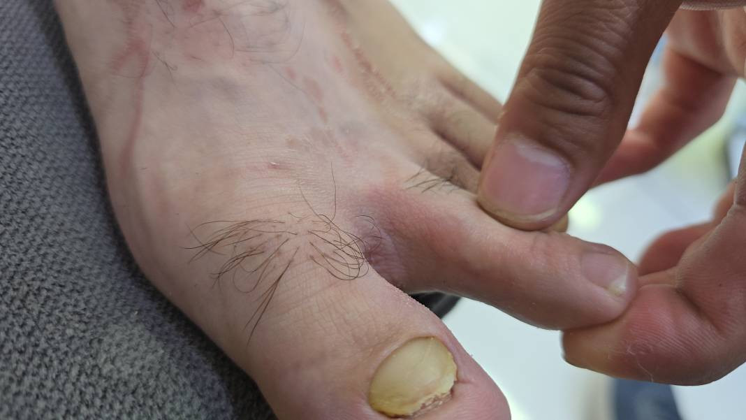 Yüzme havuzunda felaket! Dokundukları gibi yanmaya başladılar - Resim: 6