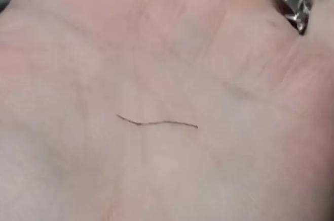 Bir parça tavuk yedi sesini kaybetti. Mangal yaparken dikkat - Resim: 5