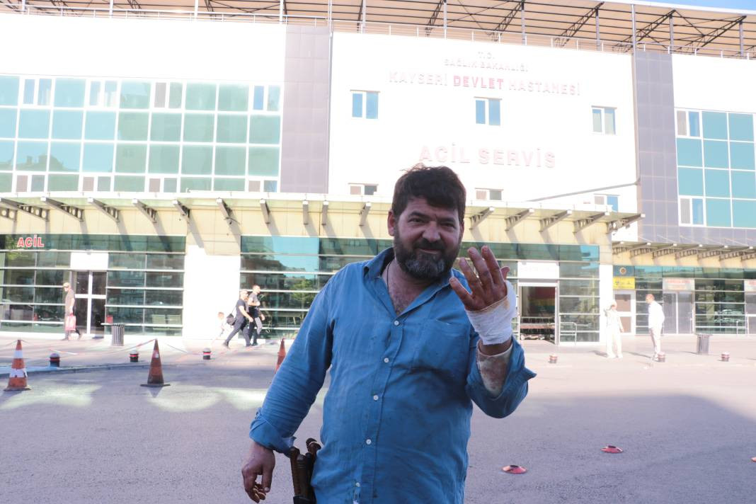 Kayseri'nin acemi kasapları hastanelere koştu - Resim: 8