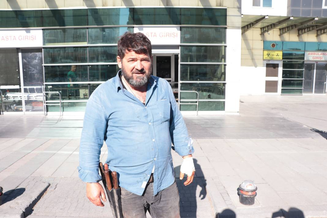 Kayseri'nin acemi kasapları hastanelere koştu - Resim: 7