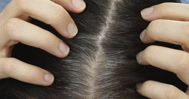 Saç diplerindeki kaşıntıya son. Mucizevi yöntem ortaya çıktı - Resim: 6