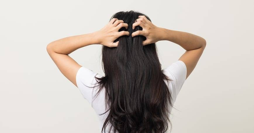 Saç diplerindeki kaşıntıya son. Mucizevi yöntem ortaya çıktı - Resim: 3