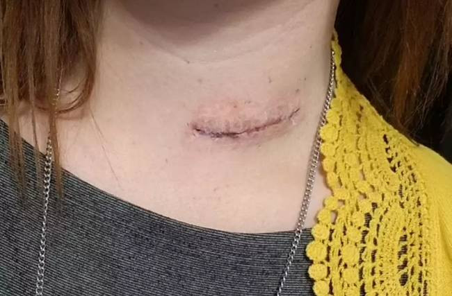 Bir parça tavuk yedi sesini kaybetti. Mangal yaparken dikkat - Resim: 9