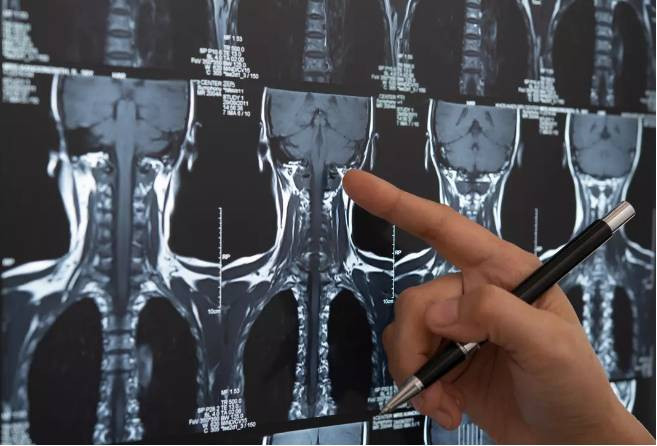 Bir parça tavuk yedi sesini kaybetti. Mangal yaparken dikkat - Resim: 10
