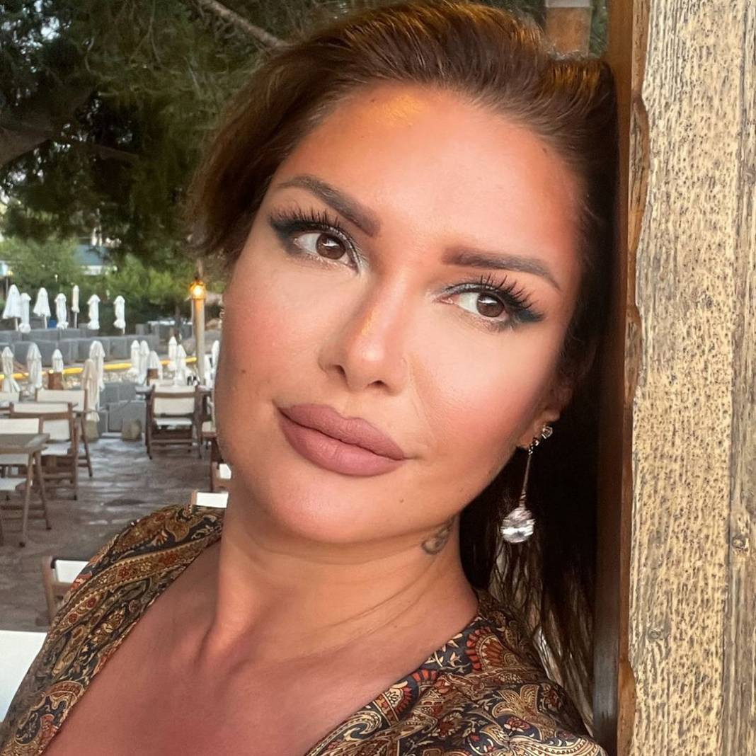 Rafet El Roman'ın eski eşi Tuğba Altıntop estetiğin dibine vurdu. O artık bambaşka biri oldu - Resim: 5