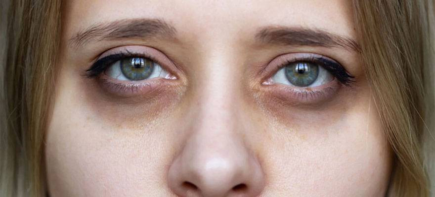 Bu fotoğraf size normal geliyorsa yanılıyorsunuz. İşte sebebi - Resim: 8