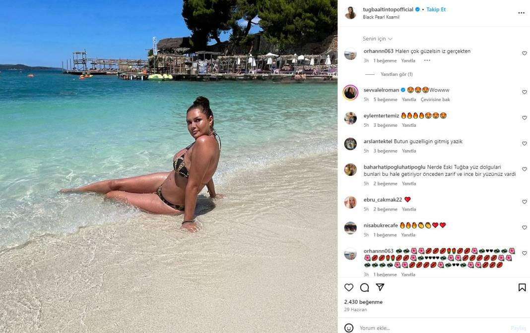 Rafet El Roman'ın eski eşi Tuğba Altıntop estetiğin dibine vurdu. O artık bambaşka biri oldu - Resim: 1