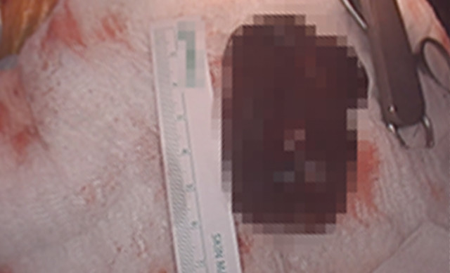 Kovid sanıldı, çıkan sonuç şoke etti - Resim: 4