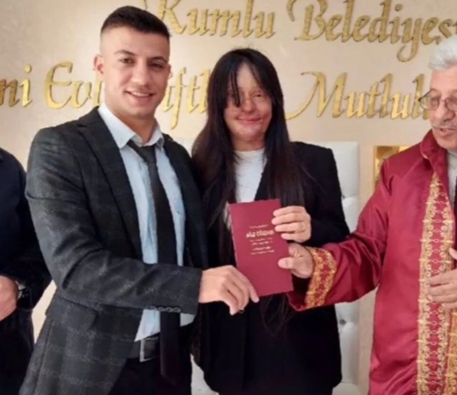 Berfin Özek yüzüne kezzap atanla evlendi - Resim: 2